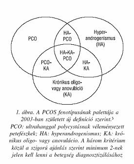 Definíció és diagnosztikus kritériumok 1935-ben Stein és Leventhal írta le először az oligo- vagy amenorrhoea és a bilaterális polycystás petefészkek együttes megjelenését 7 megfigyelt eset alapján.