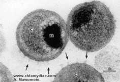 Chlamydia genus Chlamydiaceae - általános