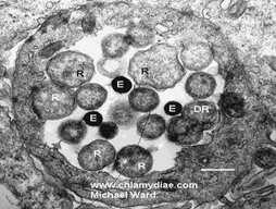 (MOMP, hősokk fehérje) Chlamydia genus Chlamydia trachomatis (ember mber) Chlamydia suis (sertés ertés) Chlamydia muridarum (egér, hörcsög) Chlamydophila genus Chlamydophila pneumoniae (ember, +?