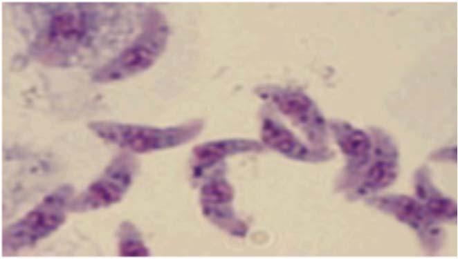Toxoplasma A toxoplazmózis kórokozója a Toxoplasma, egy egysejtű,