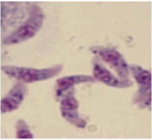 fagoszóma membránjának roncsolása Trypanosoma Ellenállás a komplement-általi