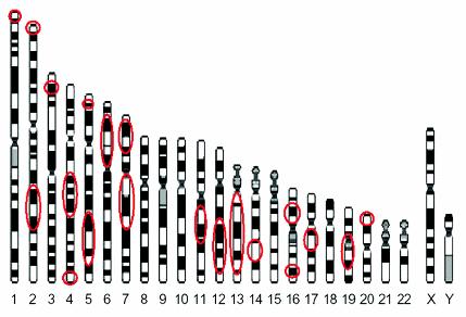 dipeptidyl peptidase 10; GPRA: G protein-coupled receptor for asthma susceptibility; HLA: human leukocyte antigen; IL1RL1: Interleukin 1 receptor-like 1; IL33: interleukin 33; ORMDL3: ORM1-like 3 (S.