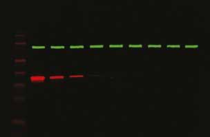 Fluoreszcens multiplexing detektálása Lehetőséget ad akár 5