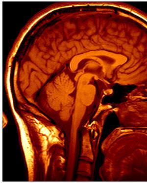 Képfeldolgozás és gépi látás bevezető 3D képalkotás - MRI, CT Képvezérelt sebészet Grimson et al., MIT 3.20.