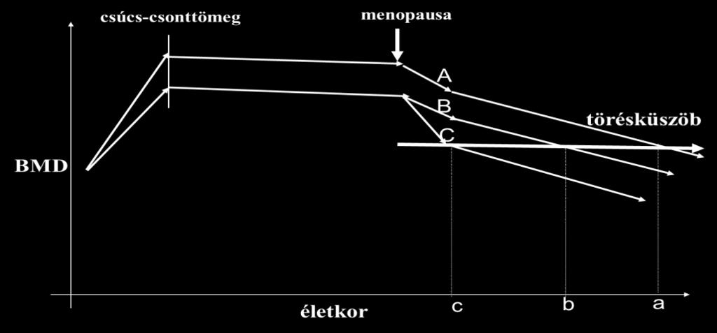 2. ábra A csonttömeg változása az életkor függvényében A, nagy csúcs-csonttömeg, normál csontvesztés B, kis csúcs-csonttömeg, normál csontvesztés C, kis csúcs-csonttömeg, gyors csontvesztés a,b,c a