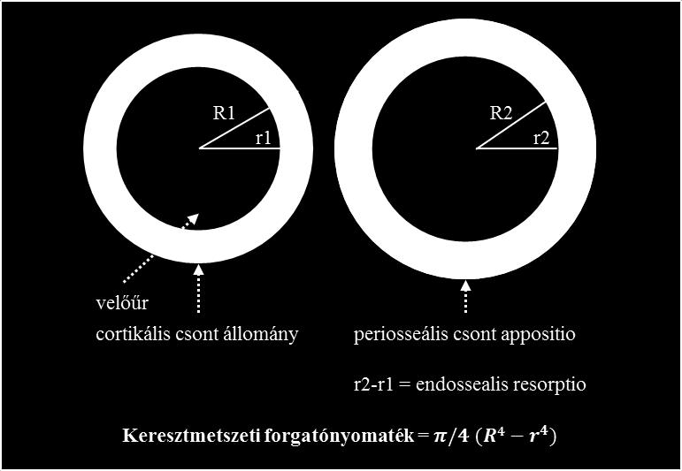 A férfi nemi hormonok, a hgh és az IGF-1 (insulin-like growth factor 1) növelik a periosseális csontépülést (27), míg az ösztrogén gátolja azt. Az ösztrogén serkenti az endosseális csontépítést.