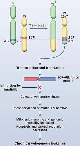 BCR-ABL1 fúziós gén