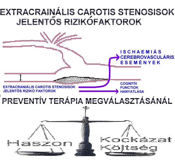 Carotis