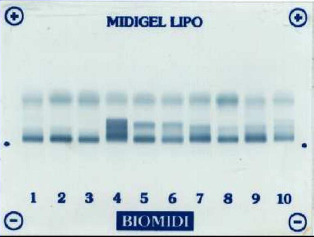 Lipoprotein elektroforézis HDL alfa VLDL