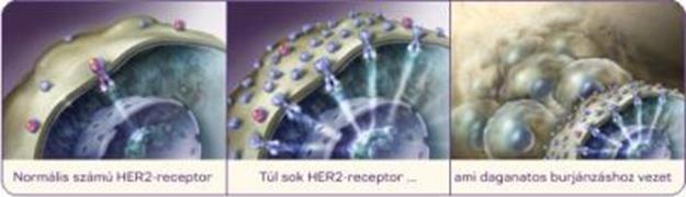 Her2 A HER2 (human epidermális növekedési faktor receptor 2-es típusa) az összes emberi sejt felszínén megtalálható receptor.