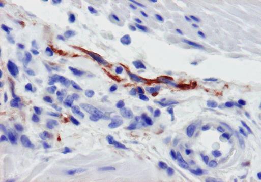 cytoplazma NORMÁL Hízósejtek Melanocyták Cajal-sejtek