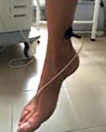 6 3. kép. Veno-arteriális reflexmérés lelógó lábon Az áramlásváltozást a fent részletezett módon szintén rögzítettük.