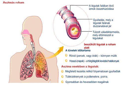 életkörülményeitől. vannak -elsősorban tünetek asztmás egyensúlyban bekorlátozzák 1. 2. 3. 4. allergénekre Nem azonban 6. 7. 8. légúti 9. szintén 5. számára betegség.