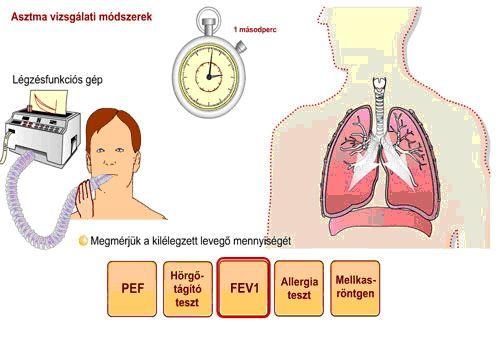 Amennyiben megítéléséhez Az anyagok csak allergiavizsgálatok kis fokú váltanak ezek légúti a következő ki a szűkületet módszerek asztmás (vérvétel, vizsgálatokat rohamot.