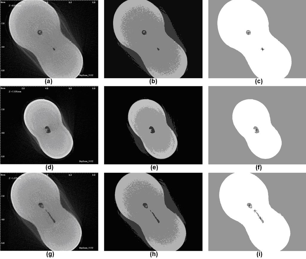 Foggyökér csatorna meghatározása CT képeken 69 2.7. ábra Metszeti képek szegmentálásának részeredményei. Mindegyik sorban egy-egy metszeti kép feldolgozásának részletei láthatóak.