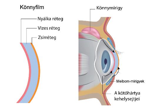 Ennek eredménye égő érzés, idegentest érzése a szemben és a látásproblémák súlyosbodása.