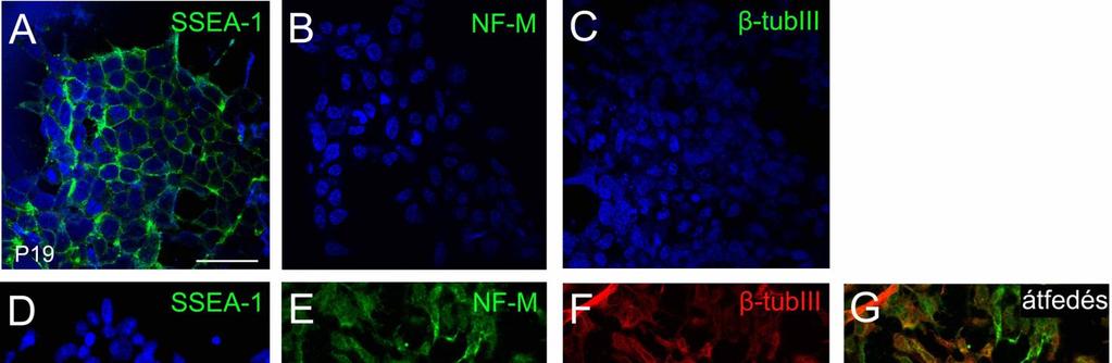 -tubuliniii-at és az intermedier filamentum NF-M fehérjét használtuk [300,301], míg az - SSEA1 ellenanyaggal a differenciálatlan sejteket tudtuk detektálni [302].
