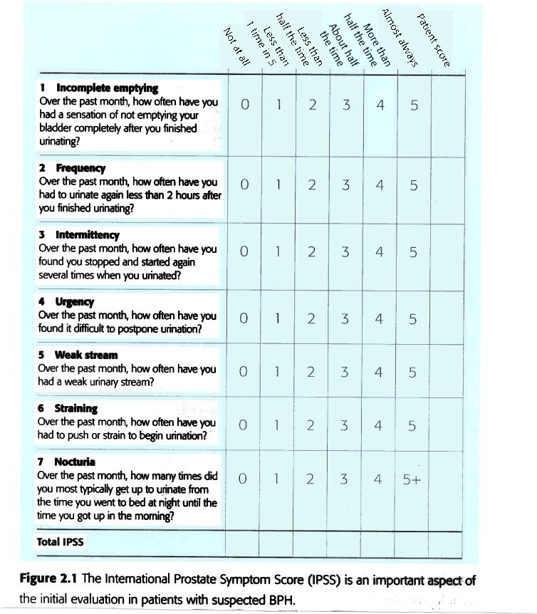 IPSS Az IPSS kérdőív kérdései 1. Milyen gyakran érzi úgy, hogy nem sikerül teljesen kiürítenie a hólyagját a vizelés során? 2. Milyen gyakran fordul elő, hogy két órán belül újra vizelnie kell? 3.