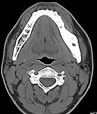 MDCT -