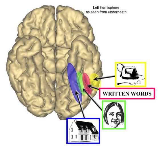 Parahippocampal gyrus Pl.