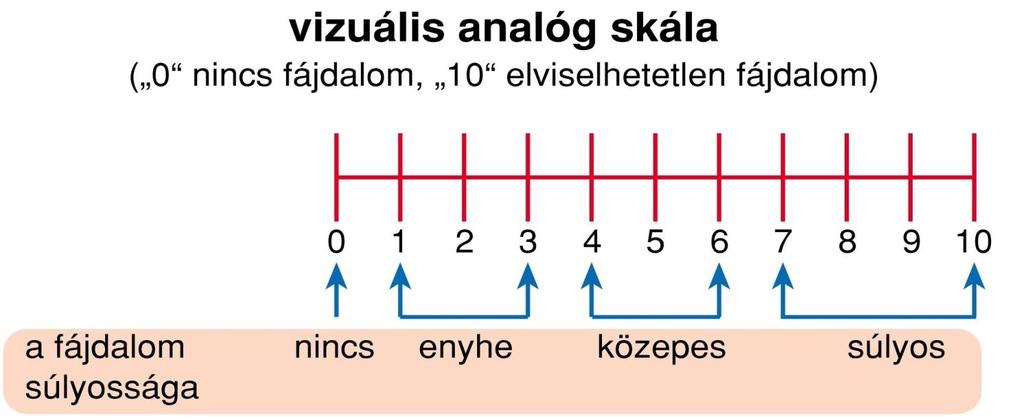 Vékonyrost-neuropátia A fájdalom égő, szúró,