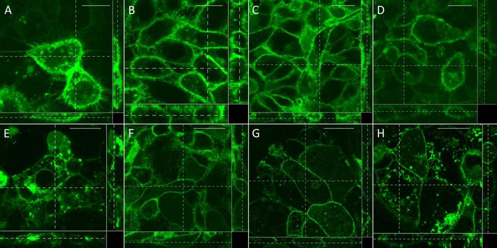 10 M elisidepsin, 30 perc Kontroll Eredmények és megbeszélésük plazmamembránban, mind az intracelluláris vezikulumokban, de 10 M elisidepsin hatására szinte teljes egészében az intracelluláris