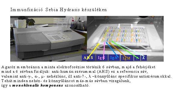 - fertőzések - autoimmun kórképek - non-hodgkin limfóma - krónikus limfoid leukémia A monoklonális komponens mennyiségi-minőségi elemzésének döntő jelentősége van a diagnózis felállításában, a