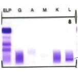 albumin alfa-1 alfa-2 béta gamma 9.