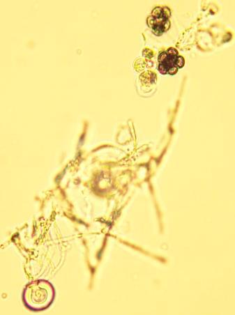 Zigospórák vizsgálata: Mucor genevensis zigospórákat sztereomikroszkóp alatt, kis nagyításnál vizsgáljuk. 2.
