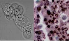 Vérben és szövetekben élő protozoonok Amoeba Naegleria Acanthamoeba Szabadon élő amoebák vizes közeg, talaj Vegetatív és cysta