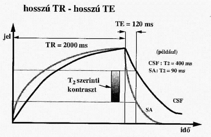 T 2 contrast (inverse