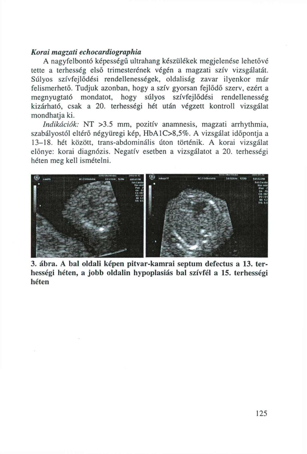 Korai magzati echocardiographia A nagyfelbontó képességű ultrahang készülékek megjelenése lehetővé tette a terhesség első trimesterének végén a magzati szív vizsgálatát.