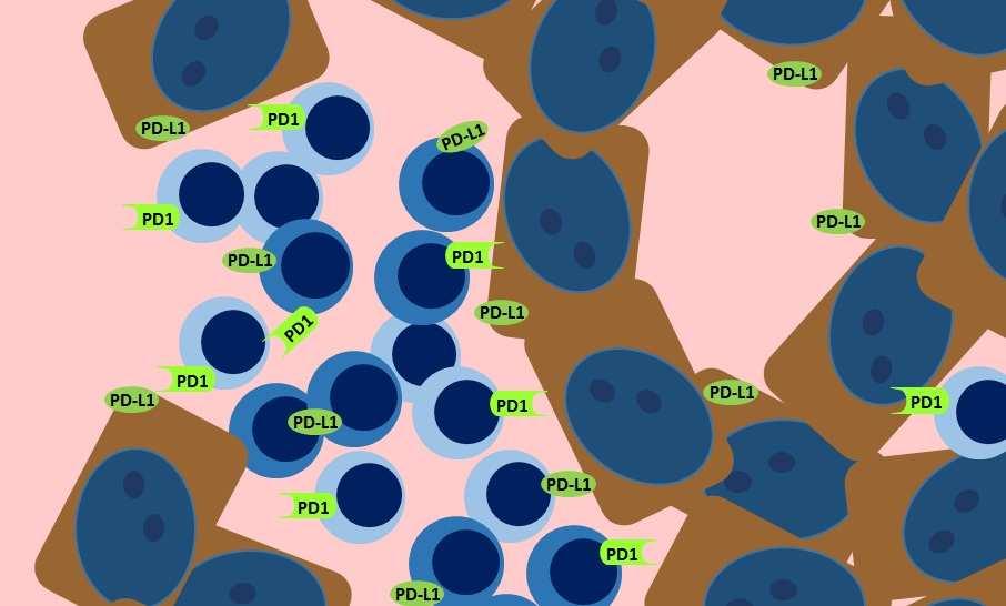 Következtetés Az immunrendszer védekező mechanizmusainak jelentős szerep jut a metasztatikus tumor progressziójának