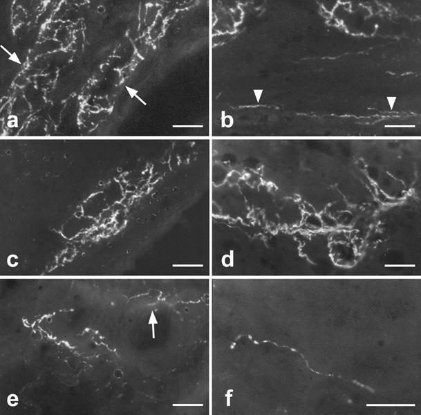 c A méh adrenerg