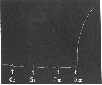 A verejtékmirigyeket sympathicus cholinerg posztganglionáris rostok idegzik be The general rule that When the sympathetic chain was postganglionic stimulated, so that beads of sweat fibres appeared