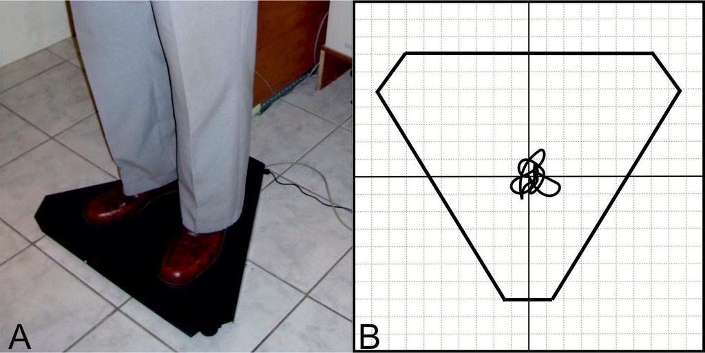 2. ábra A poszturográfiás platform (A) és sematikus rajza (B).