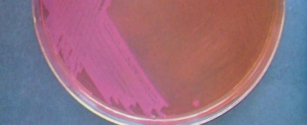 Enterobacteriaceae Clostridiumok Kórokozók Citrobacter Enterobacter Escherichia