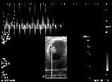 TOVÁBBI LEHETOSÉGEK TOVÁBBI LEHETOSÉGEK urinary bladder cardiologia