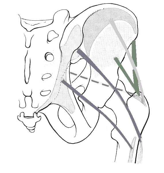 26 2. ábra: M. gluteus maximus, medius et minimus; M.