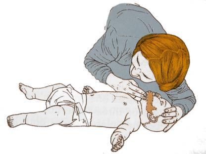 ÖTÖDIK LÉPÉS Légzésvizsgálat (10 másodperc) Ha már szabad a légút, hajoljunk a baba arca fölé és röviden vizsgáljuk meg, hogy továbbra sincs-e légzés (nem emelkedik-süllyed a mellkas, nem hallatszik