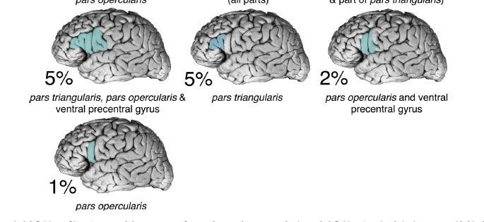 hogy melyik a Broca