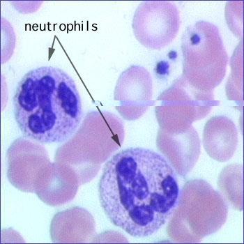 Eosinophil granulocyta: keringésből szövetbe migrálnak= Diapedezis érés szövetben (interleukinok) védelem: paraziták; allergiás reakciókban megemelkedett számban gastrointesztinális rendszer,