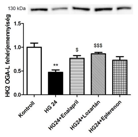 órán (HG 48) keresztül. Reprezentatív immunoblottok a hosszú (A: L-OGA, 130 kda) és a rövid (B: OGA-S, 75 kda) OGA izoformáról.