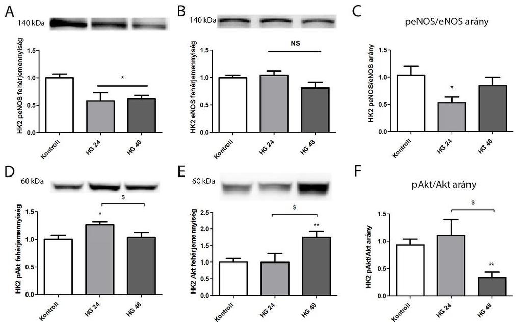 11. ábra Foszforilált és totál enos és Akt szintek proximális tubulussejtekben magas glükóz kezelés után Reprezentatív immunoblottok a foszforilált enos (Ser1177) (A: penos; 140 kda), enos (B: 140