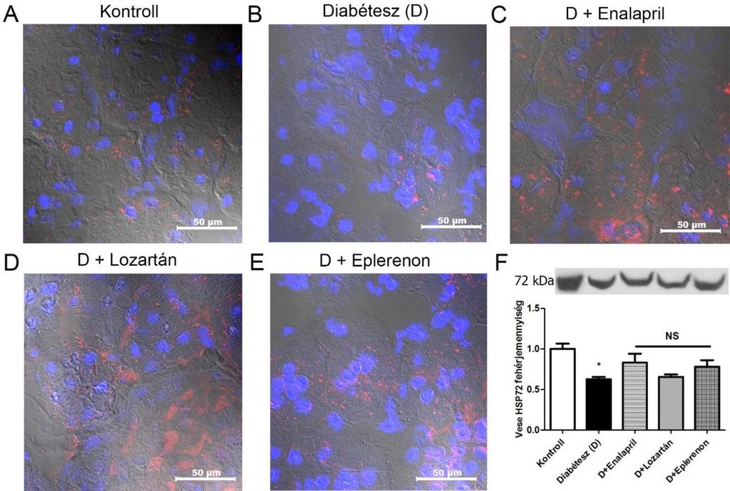 4.8. HSP72 fehérjemennyiség és lokalizáció változása diabéteszes vesében A cukorbeteg állatok veséjében a HSP72 fehérje mennyiségének csökkenését figyeltük meg a kontrollokhoz képest, ami a