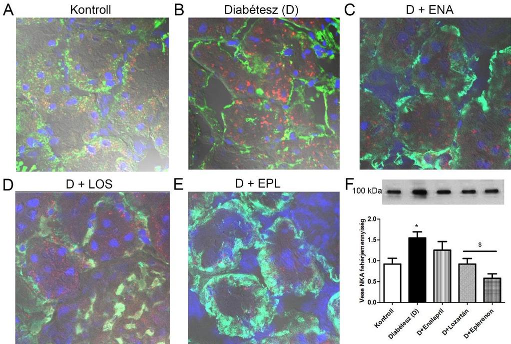 4.9. A NKA fehérjemennyiség és lokalizáció változása diabéteszes vesében Korábbi eredményeink alapján a NKA fehérje mennyisége nőtt az STZ-indukált diabéteszes vesében, ami AngII kezelés hatására