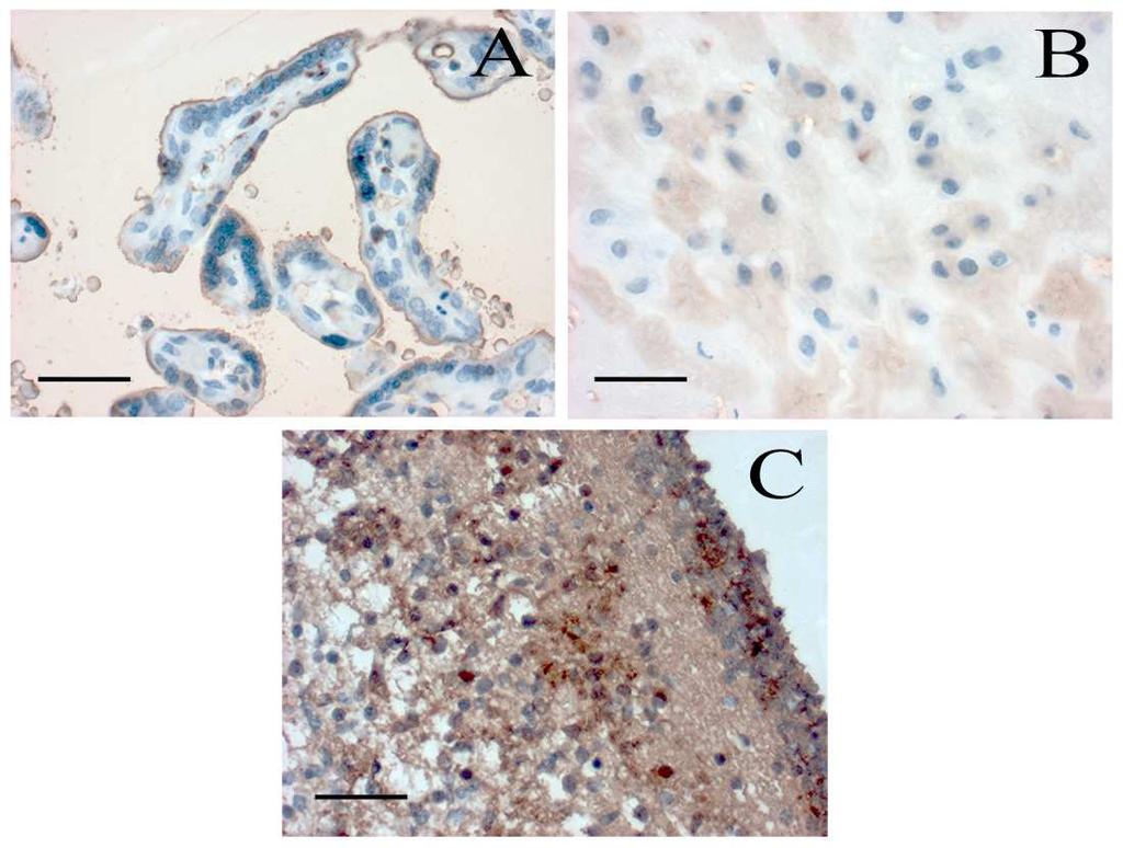 ábra Erős kannabinoid receptor 1 (CB1)-specifikus festődés praeeclampsiás chorionbolyhokban (A) és