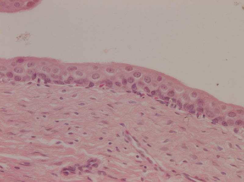 Vesica urinaria: tunica mucosa ernyısejtek lamina