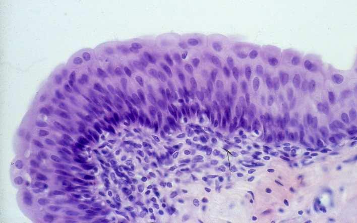 Vesica urinaria: urothelium Körte alakú sejtek