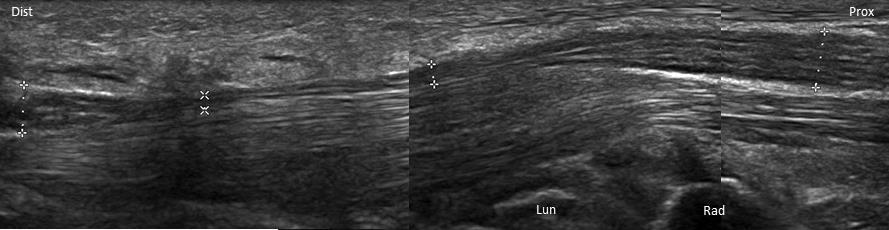 musculoskeletalis betegséghez társuló neuropathiák és az idegtumorok diagnosztikája.